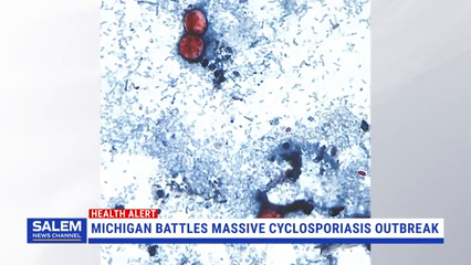 Michigan Battles Massive Cyclosporiasis Outbreak